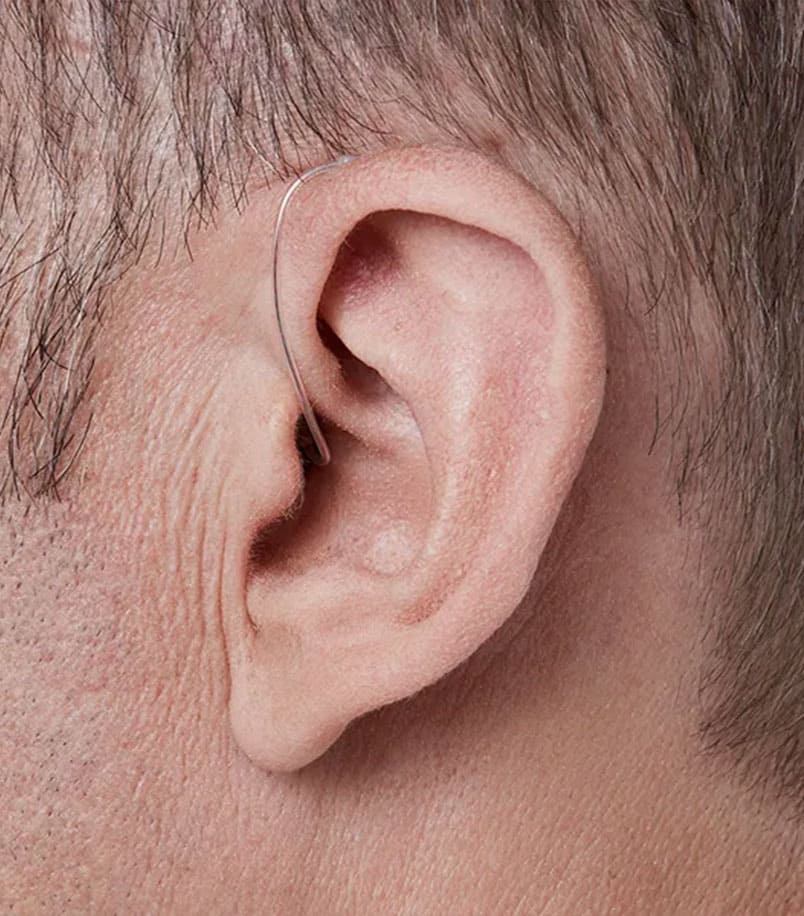 Mini-Contour d'oreilles